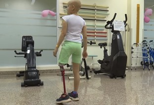 Fábrica de próteses do Hospital de Amor ajuda na reabilitação de pacientes amputados